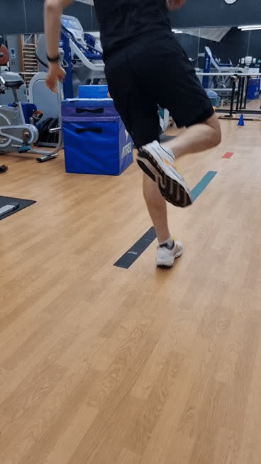 Single leg hopping at 8 months post Achilles repair
